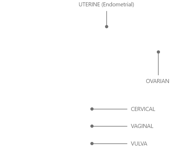 Gynae cancers start in a woman’s reproductive organs – ovaries